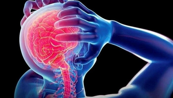 Cluster headache nedir? Küme baş ağrısı nedir?